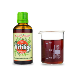 Niewystarczająca pigmentacja (bielactwo) krople (nalewka) 50 ml